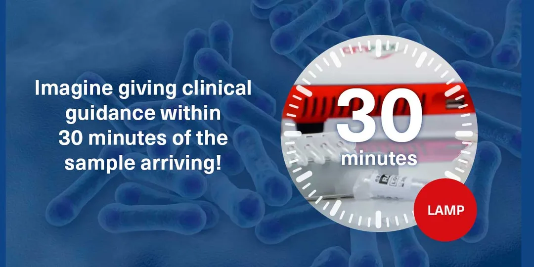 With amplex eazyplex, you can get results in 30 minutes